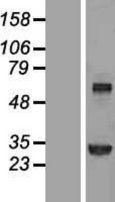 Western Blot: Transglutaminase 2/TGM2 Overexpression Lysate [NBL1-16867]