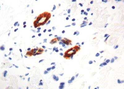 Immunohistochemistry-Paraffin: Transglutaminase 2/TGM2 Antibody (CUB7402) [NBP2-26458]