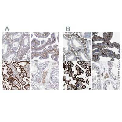 Immunohistochemistry-Paraffin: Transglutaminase 2/TGM2 Antibody [NBP1-86951]