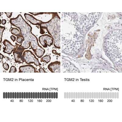 Immunohistochemistry-Paraffin: Transglutaminase 2/TGM2 Antibody [NBP1-86951]