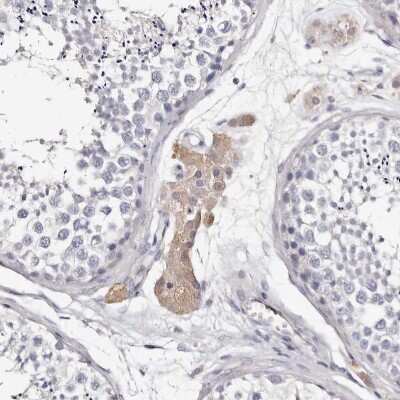 Immunohistochemistry-Paraffin: Transglutaminase 2/TGM2 Antibody [NBP1-86951]