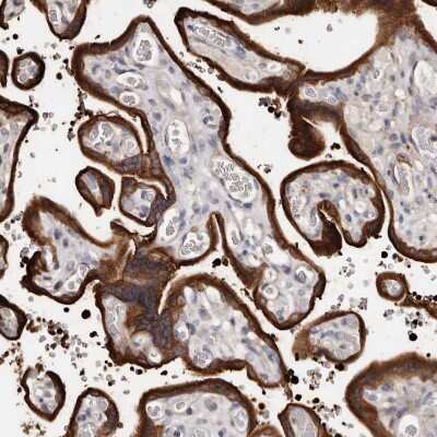 Immunohistochemistry-Paraffin: Transglutaminase 2/TGM2 Antibody [NBP1-86951]