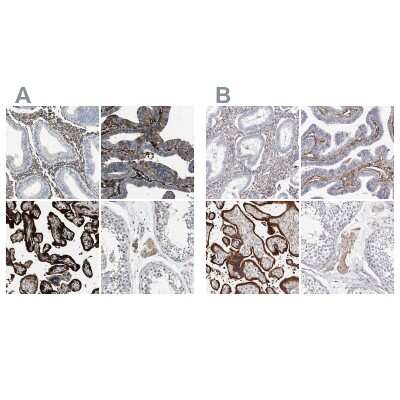 Immunohistochemistry-Paraffin: Transglutaminase 2/TGM2 Antibody [NBP1-86952]