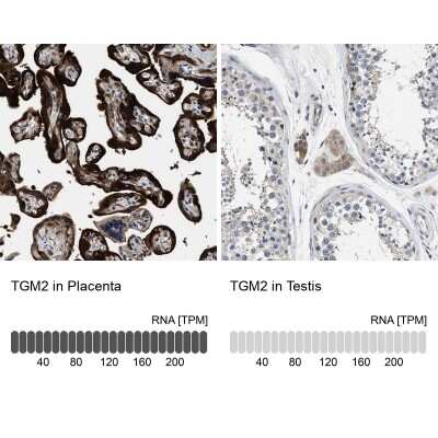 Immunohistochemistry-Paraffin: Transglutaminase 2/TGM2 Antibody [NBP1-86952]
