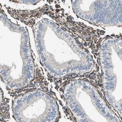 Immunohistochemistry-Paraffin: Transglutaminase 2/TGM2 Antibody [NBP1-86952]