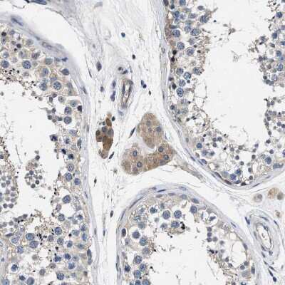 Immunohistochemistry-Paraffin: Transglutaminase 2/TGM2 Antibody [NBP1-86952]