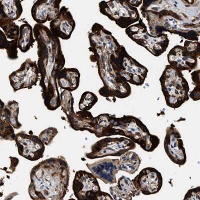 Immunohistochemistry-Paraffin: Transglutaminase 2/TGM2 Antibody [NBP1-86952]