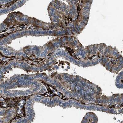 Immunohistochemistry-Paraffin: Transglutaminase 2/TGM2 Antibody [NBP1-86952]