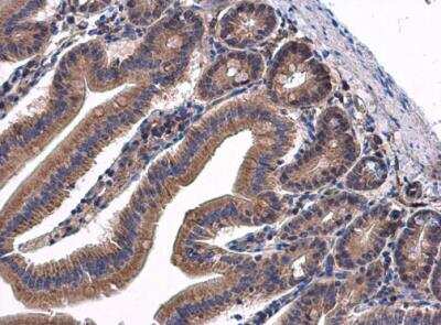 Immunohistochemistry-Paraffin: Transglutaminase 2/TGM2 Antibody [NBP2-20698]