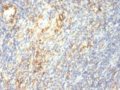 Immunohistochemistry-Paraffin: Transglutaminase 2/TGM2 Antibody (TGM2/419) - Azide and BSA Free [NBP2-47926]