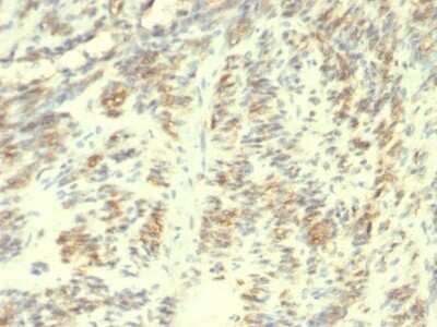 Immunohistochemistry-Paraffin: Transglutaminase 2/TGM2 Antibody (TGM2/419) - Azide and BSA Free [NBP2-47926]