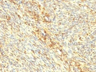 Immunohistochemistry-Paraffin: Transglutaminase 2/TGM2 Antibody (TGM2/419) - Azide and BSA Free [NBP2-47926]