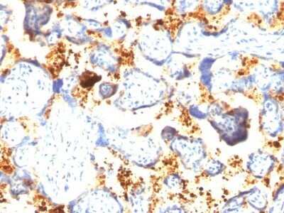 Immunohistochemistry-Paraffin: Transglutaminase 2/TGM2 Antibody (SPM358) - Azide and BSA Free [NBP2-47927]