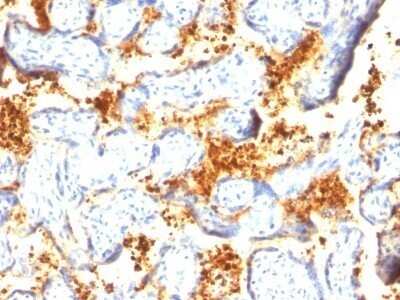 Immunohistochemistry-Paraffin: Transglutaminase 2/TGM2 Antibody (TGM2/419) - IHC-Prediluted [NBP2-48083]
