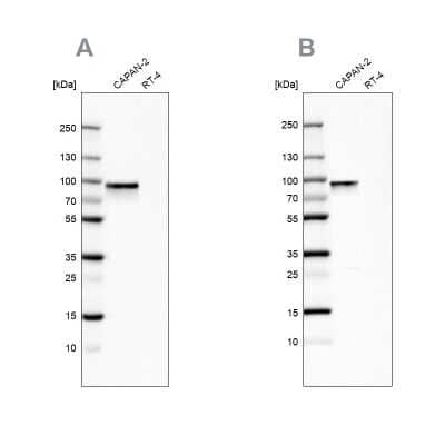 Western Blot: Transglutaminase 2/TGM2 Antibody [NBP1-86951]