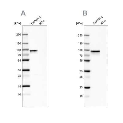 Western Blot: Transglutaminase 2/TGM2 Antibody [NBP1-86952]