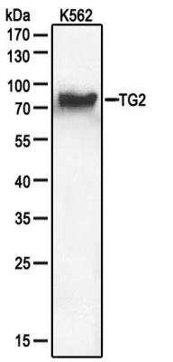 Western Blot: Transglutaminase 2/TGM2 Antibody [NBP2-24470]