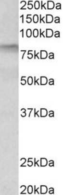 Western Blot: Transglutaminase 3/TGM3 Antibody [NBP1-97769]