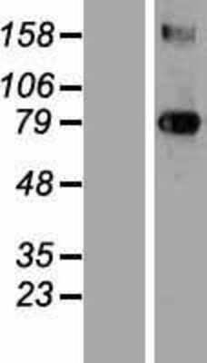 Western Blot: Transglutaminase 3/TGM3 Overexpression Lysate [NBP2-10879]