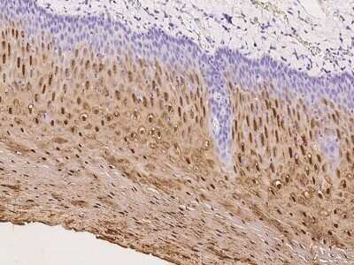 Immunohistochemistry-Paraffin: Transglutaminase 3/TGM3 Antibody [NBP2-97324]