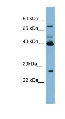 Western Blot: Transglutaminase 3/TGM3 Antibody [NBP1-57678]