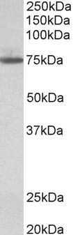 Western Blot: Transglutaminase 4/TGM4 Antibody [NBP1-97776]