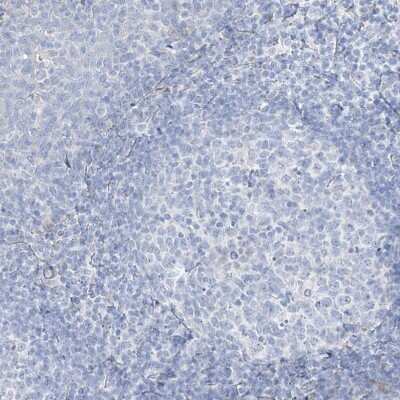 Immunohistochemistry-Paraffin: Transglutaminase 4/TGM4 Antibody [NBP1-86947]