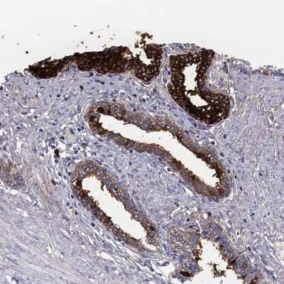 Immunohistochemistry-Paraffin: Transglutaminase 4/TGM4 Antibody [NBP3-17095]