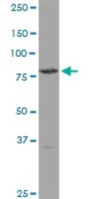 Western Blot: Transglutaminase 4/TGM4 Antibody [H00007047-B01P]