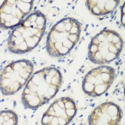 Immunohistochemistry-Paraffin: Transglutaminase 5 Antibody - BSA Free [NBP2-94524]