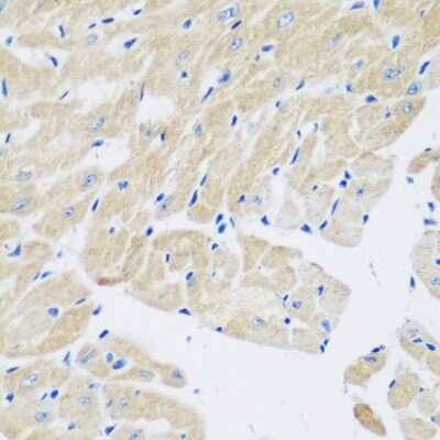 Immunohistochemistry-Paraffin: Transglutaminase 5 Antibody - BSA Free [NBP2-94524]
