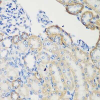 Immunohistochemistry-Paraffin: Transglutaminase 5 Antibody - BSA Free [NBP2-94524]