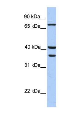 Western Blot: Transglutaminase 5 Antibody [NBP1-54329]