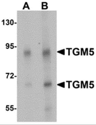 Western Blot: Transglutaminase 5 AntibodyBSA Free [NBP2-81857]