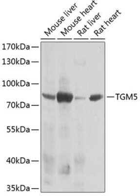 Western Blot: Transglutaminase 5 AntibodyBSA Free [NBP2-94524]