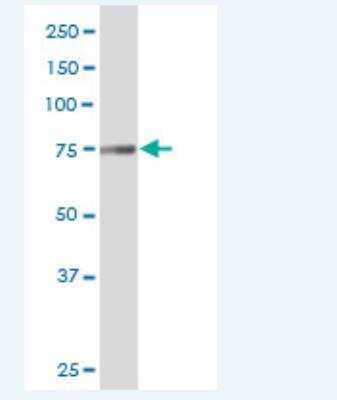 Western Blot: Transglutaminase 7/TGM7 Antibody [H00116179-B01P-50ug]