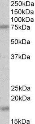 Western Blot: Transglutaminase 7/TGM7 Antibody [NBP1-68858]