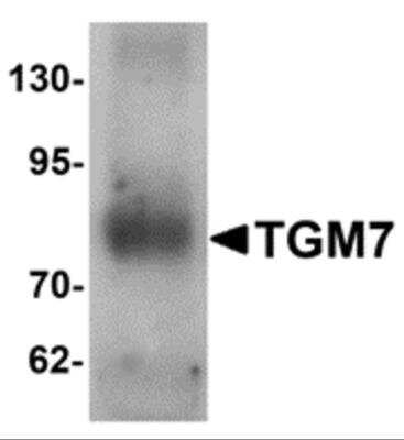 Western Blot: Transglutaminase 7/TGM7 AntibodyBSA Free [NBP2-81763]