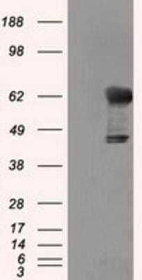 Western Blot: Transketolase Antibody (OTI5H3) [NBP2-02292]