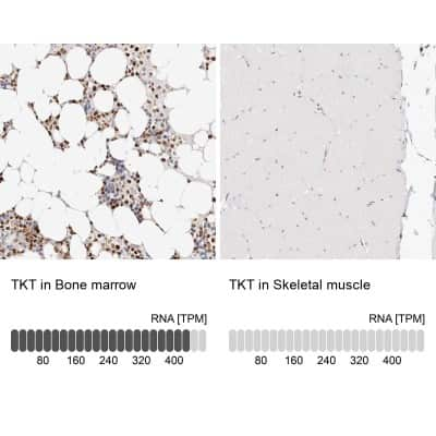 Immunohistochemistry-Paraffin: Transketolase Antibody [NBP1-87441]