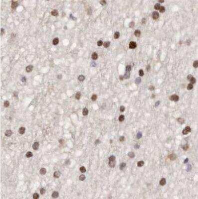 Immunohistochemistry-Paraffin: Transketolase Antibody [NBP1-87441]