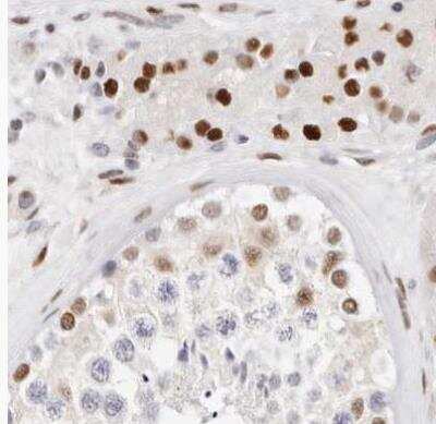 Immunohistochemistry-Paraffin: Transketolase Antibody [NBP1-87441]
