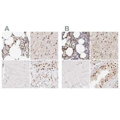 Immunohistochemistry-Paraffin: Transketolase Antibody [NBP1-87441]