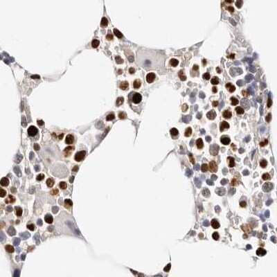 Immunohistochemistry-Paraffin: Transketolase Antibody [NBP1-87441]