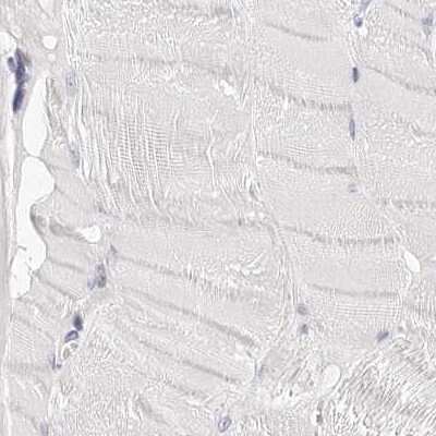 Immunohistochemistry-Paraffin: Transketolase Antibody [NBP1-87441]