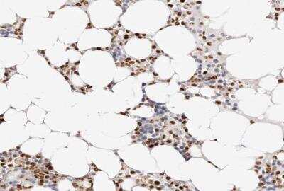 Immunohistochemistry-Paraffin: Transketolase Antibody [NBP1-87441]