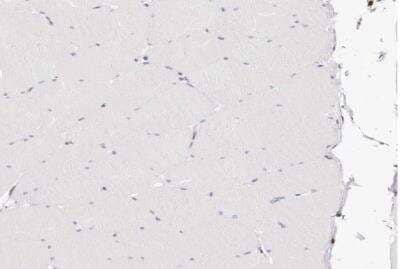 Immunohistochemistry-Paraffin: Transketolase Antibody [NBP1-87441]