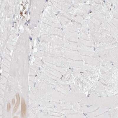 Immunohistochemistry-Paraffin: Transketolase Antibody [NBP1-87442]