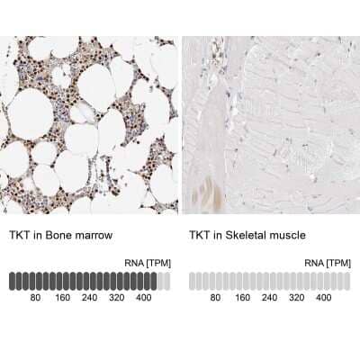 Immunohistochemistry-Paraffin: Transketolase Antibody [NBP1-87442]