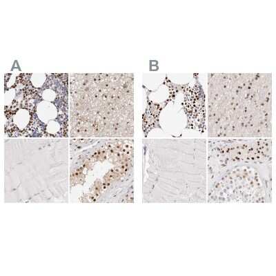 Immunohistochemistry-Paraffin: Transketolase Antibody [NBP1-87442]